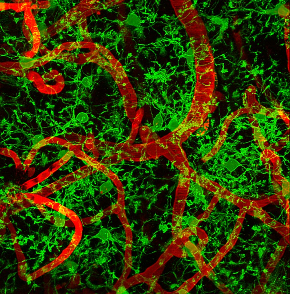 Imagerie de microglie et vaisseaux cérébraux